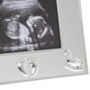 Silver Plated Baby's Scan Photo Frame with Embossed Detail 5" x 3.5"